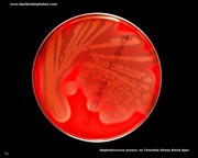 staphylococcus on blood agar